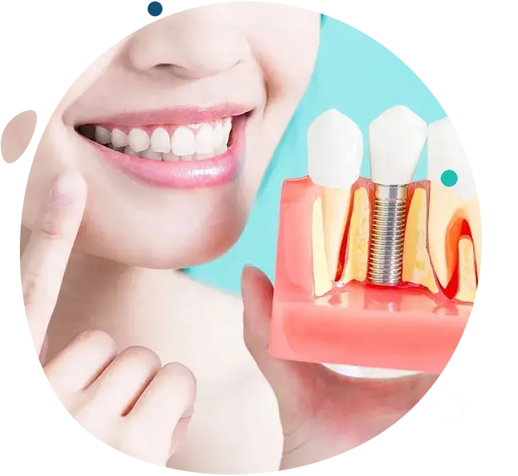 Implantologia dentale